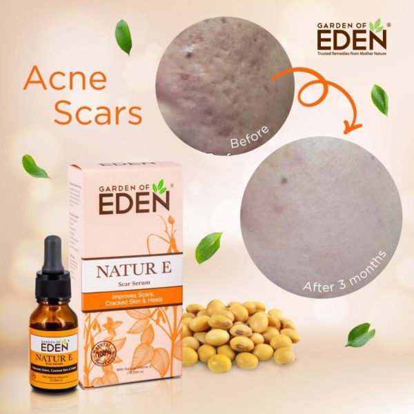 Garden Of Eden Natur E Scar Serum 15ml Online Sale